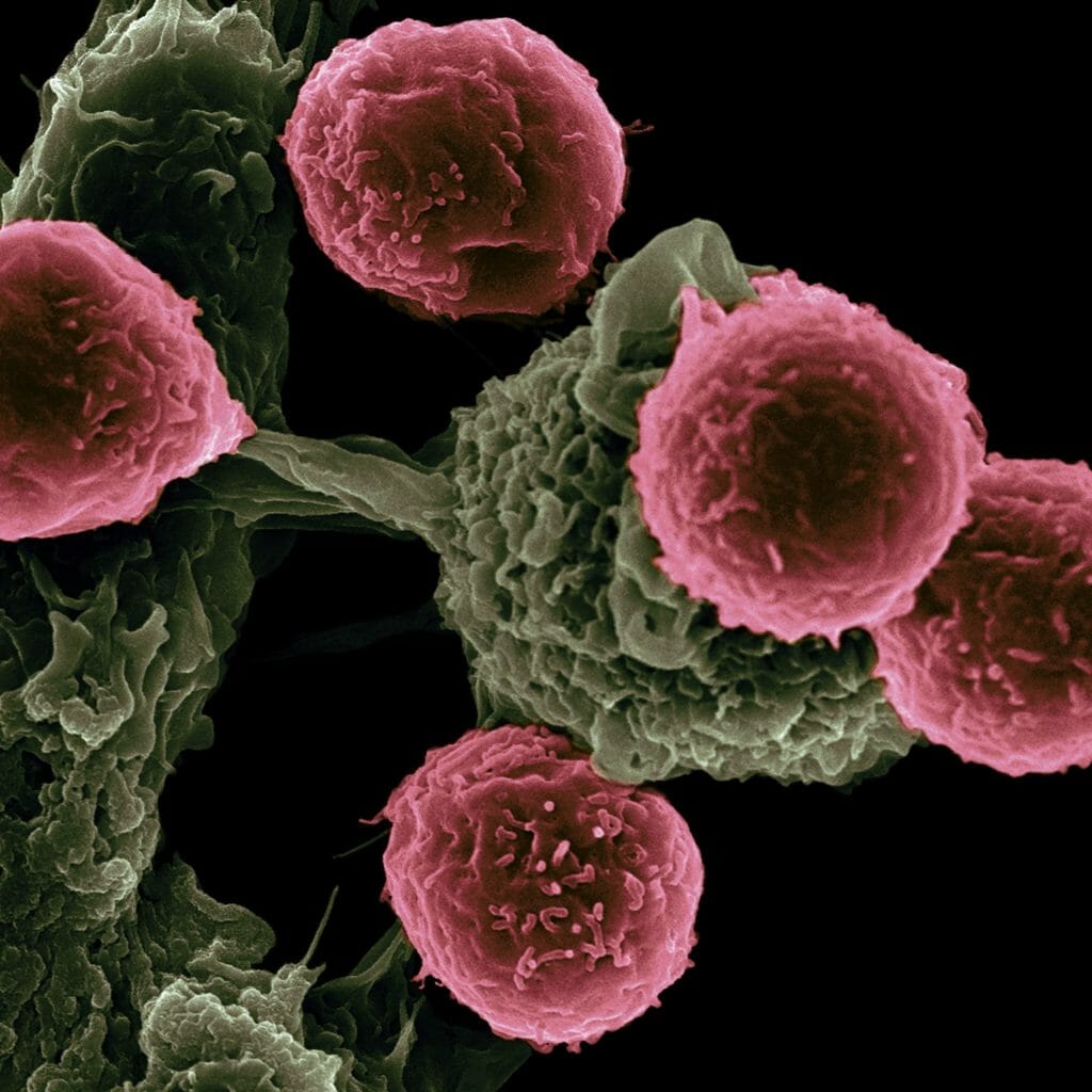 Cancer is an age-related diseases, meaning its risk increases rapidly with age.