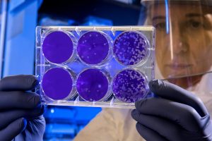 Research in the field of stem cells and longevity continues to break new ground, uncovering the role of these cells in extending healthy lifespan.